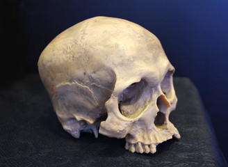 weathered human skull