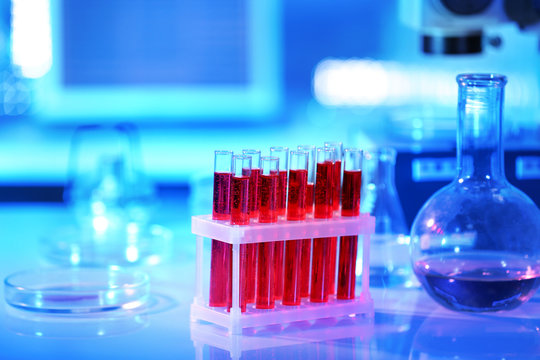 Test Tubes With Blood In Laboratory On Table