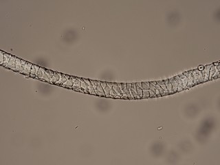 Fibre of wool