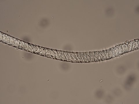 Fibre of wool