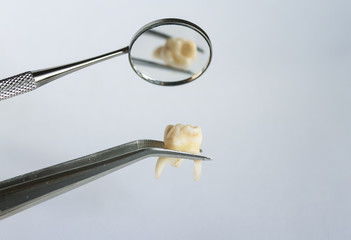 pulled out a bad tooth in the forceps of the dentist