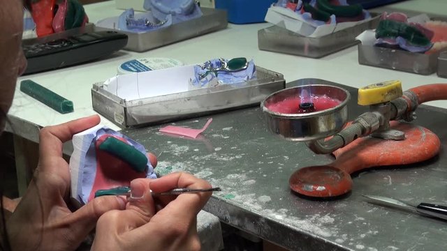 Dentist is applying hot wax into a mold. Dental technologist, the restorations may be formed directly in the mouth or may be cast using the lost-wax technique, such as for some inlays and onlays.