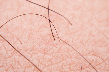 Human skin texture with black hairs on the skin