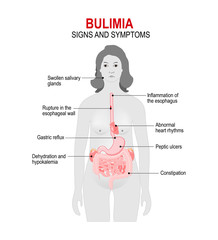Bulimia. Signs and symptoms - obrazy, fototapety, plakaty