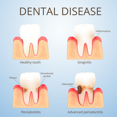 structure of human teeth