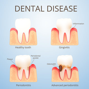 structure of human teeth