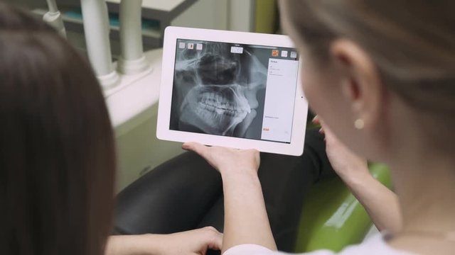 Dentist shows the patient's teeth picture on the tablet. 4k footage. Dental clinic. Close-up.