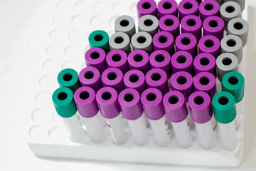 Blood Collection Tube  in Laboratory