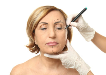 Obraz premium Surgeon hands drawing marks on female face for plastic operation