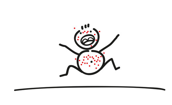 Schreiendes Kleinkind mit Ausschlag, schwere Kinderkrankheiten, Masern, Mumps, Pocken, R&ouml;teln, Windpocken, Neurodermitis, Impfpflicht, Virus, Virusinfekt, Vektor isoliert