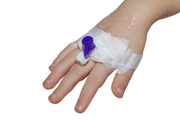 Peripheral intravenous catheter in the vein of child hand isolated on white close-up
