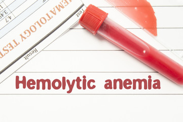 Diagnosis Hemolytic Anemia. Notepad with text labels Hemolytic Anemia, laboratory test tubes for the blood, blood smear for microscopy, and results of laboratory test of blood on table at the doctor