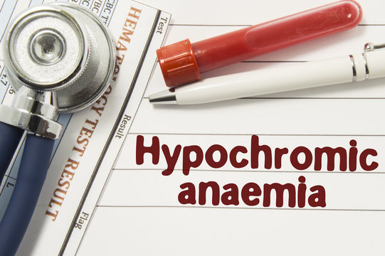 Diagnosis of Hypochromic Anaemia. Test tubes or bottles for blood, stethoscope and laboratory hematology analysis surrounded by text title of diagnosis of Hypochromic Anaemia lie in doctor workplace