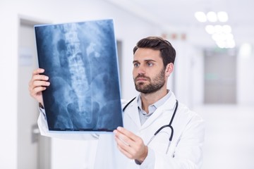 Male doctor examining x-ray - obrazy, fototapety, plakaty