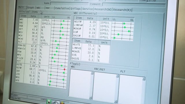 Laboratory analysing of blood. Close-up shot of monitor with results of blood test on it. HD