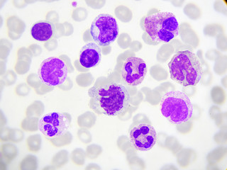 Fototapeta na wymiar White blood cells in blood smear, Wright stain