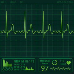 Heart monitor