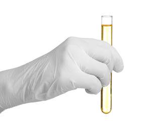 Hand in glove holding test tube with urine on white background