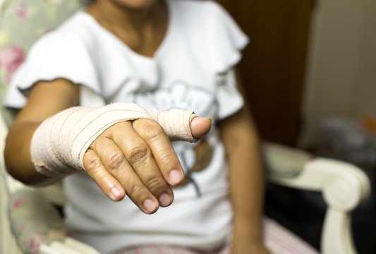 Woman sitting on a chair with Splint broken bone on her hand