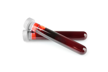 Test tubes with blood samples isolated on white