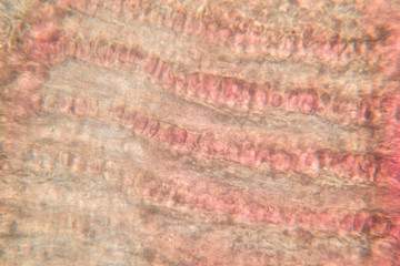 Gills of fish ,protozoa and Trichodina spp. under the microscope.(soft focus and have Grain/Noise )