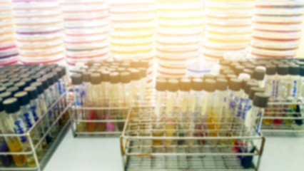 Abstract blur as background of Specimen blood tube and blood aga
