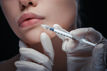 Close-up view of cosmetic lip injection with syringe