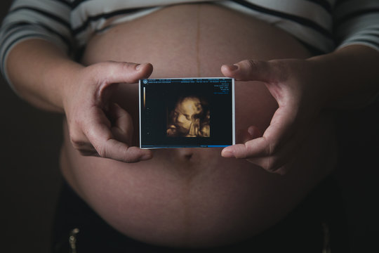 Ecografia y embarazada