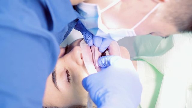 The dentist makes a form for removing the impression from the patient's teeth girl. The doctor makes perfectly straight teeth and a beautiful white smile with the help of veneers.