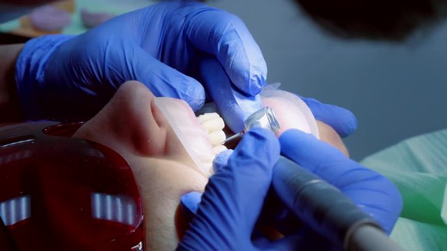 Visit to the dentist. Turning the enamel between the teeth for crowns sticker. Cosmetic dentistry veneers.