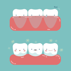 Gum surgery for nice teeth of dental