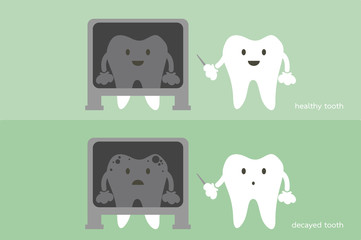 tooth dentist x-ray healthy and unhealthy teeth
