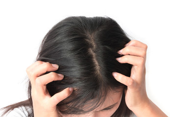 Closeup woman hand itchy scalp, Hair care concept