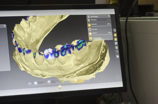 Dental technician is designing a dental crown with a computer.