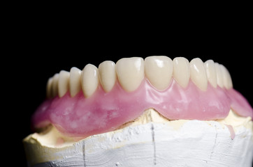 Fototapeta na wymiar Closeup of dental prosthesis porcelain teeth in a mold