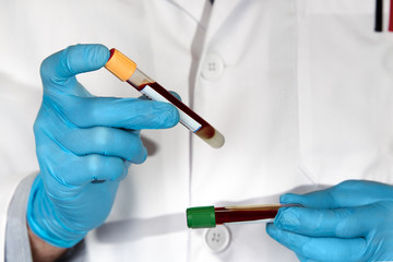hands of technician holding blood tubes in the laboratory / physician examining two tubes with...