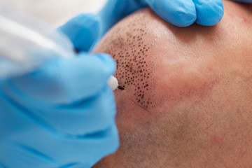 professional tattooist making permanent make up tricopigmentation