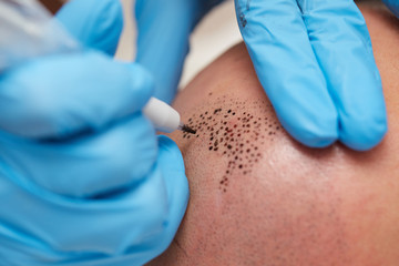 professional tattooist making permanent make up tricopigmentation