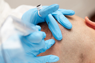 Fototapeta premium professional tattooist making permanent make up tricopigmentation