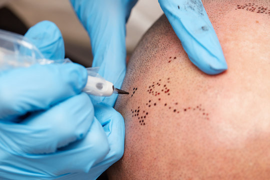 professional tattooist making permanent make up tricopigmentation
