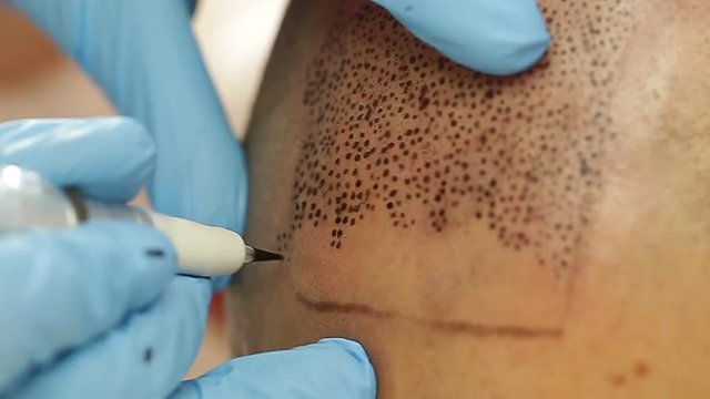 professional tattooist making permanent make up tricopigmentation