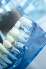 Dental teeth dentistry model