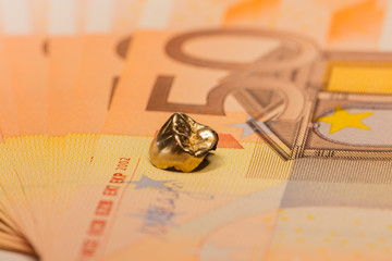 Zahngold Goldzahn Geld Ausgabe Inlay Kosten Versicherung zahn Zusatzversicherung Goldkrone...