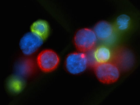 Microscopic image of circulating breast cancer cell cluster