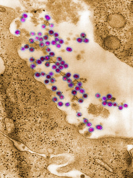 Full frame microscopic image of rubella virus virions in the process of budding from the host cell surface to be freed into the host&rsquo;s system, producing an enveloped virus particle