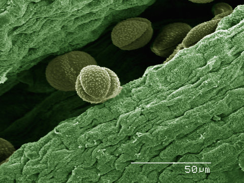 Scanning electron micrograph of pollen from an enemion flower