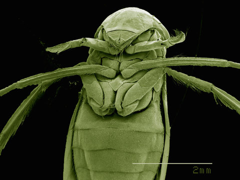 Scanning electron micrograph of the head of a female backswimmer (hemiptera: corixidae)