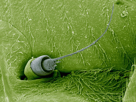 Scanning electron micrograph of the antenna of a planthopper (Hemiptera: Fulgoridae)