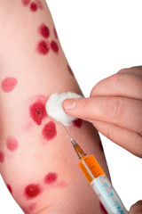 chickenpox and syringe