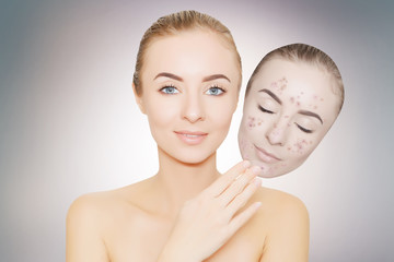 woman takes away mask with acne and pimples,grey background